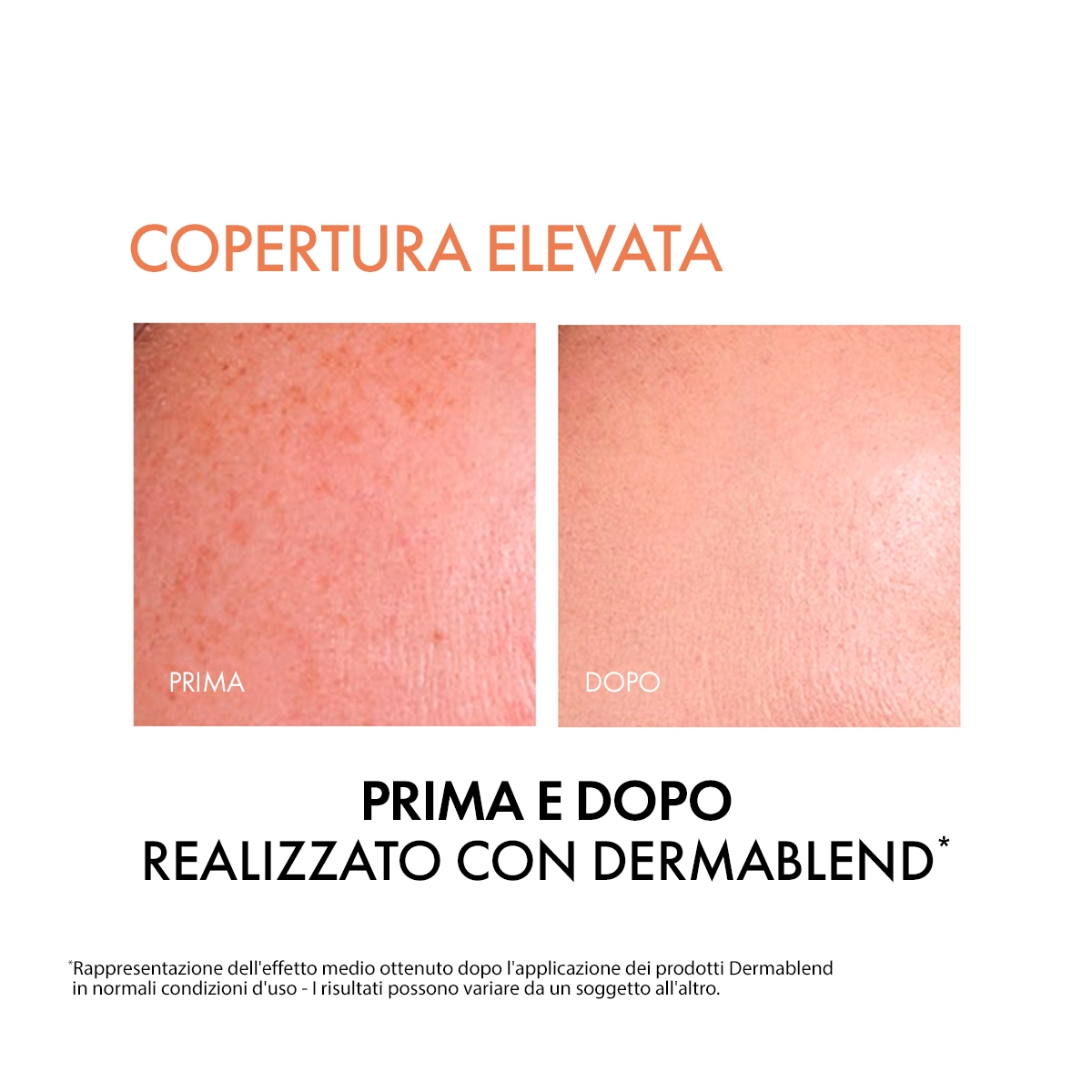 Vichy Dermablend Fondotinta Correttore Fluido 16h tonalità 25 - 30 ml correttore fino a 16 ore
