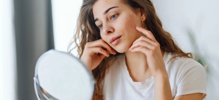 Couperose: cos’è e come trattarla con prodotti dermocosmetici