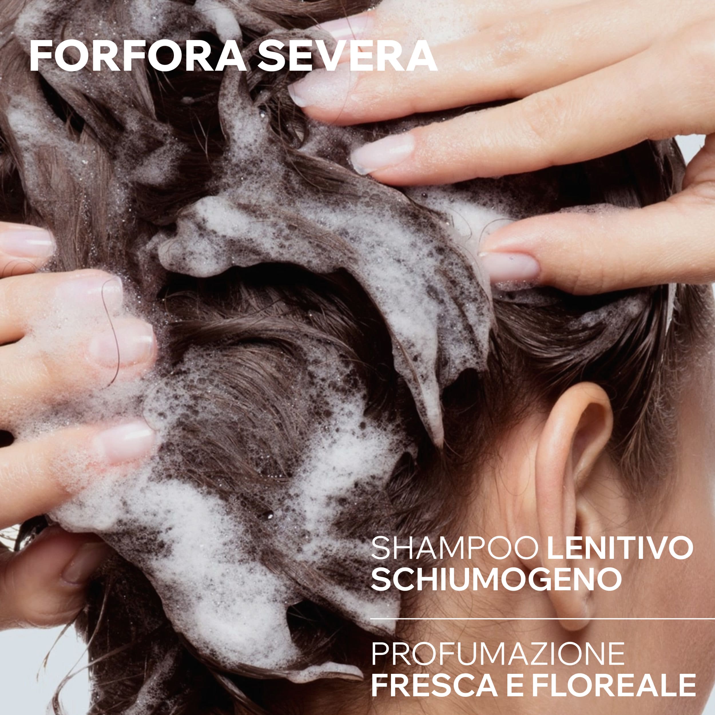 Uriage DS Hair - Shampoo Cheratoriduttore Per Forfora Severa, Secca E Grassa 150 ml