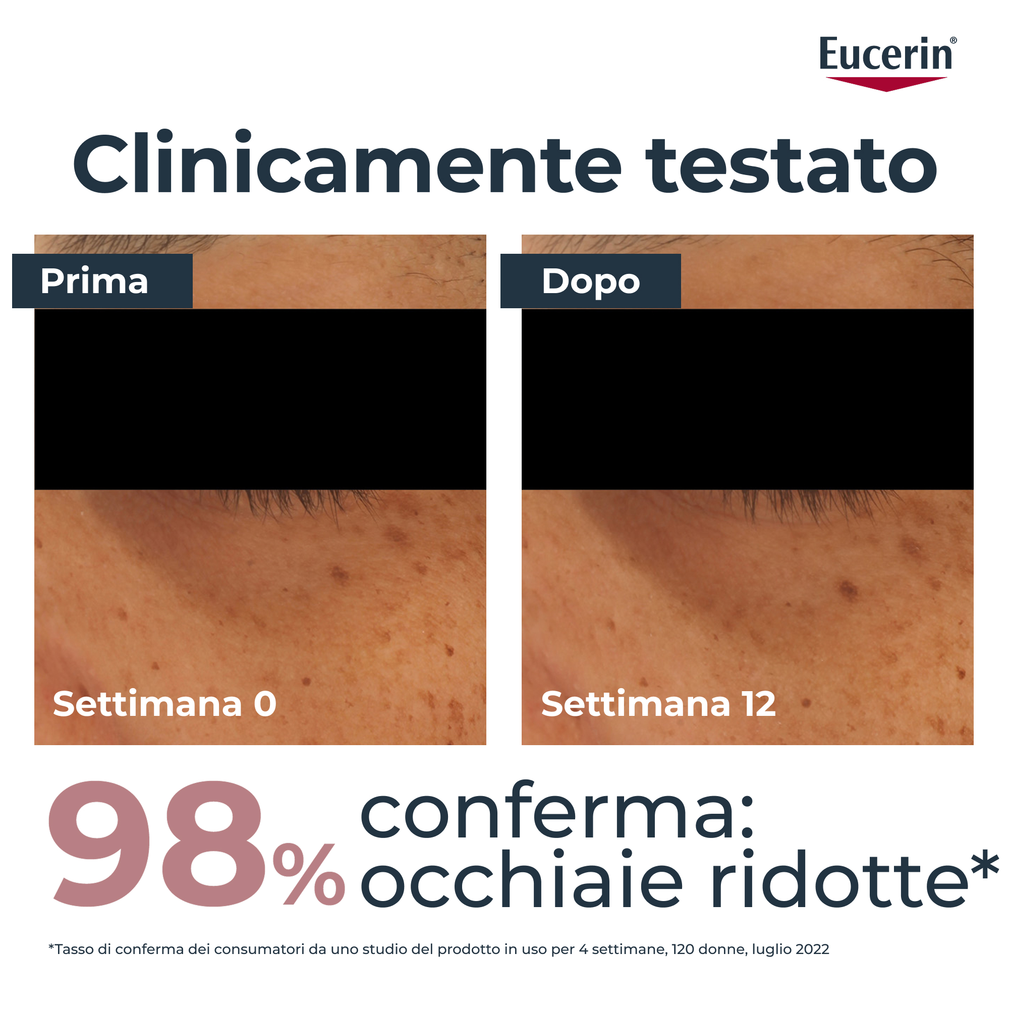 EUCERIN A-Pigment Cont.Occhi