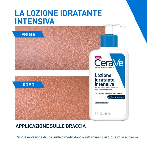 CeraVe Lozione Idratante Intensiva per Pelle Secca e Molto Secca con Sensazione di Prurito, con Hydro-Urea e Burro di Karité, idrata intensamente la pelle e da sollievo immediato alla sensazione di prurito, 236 ml