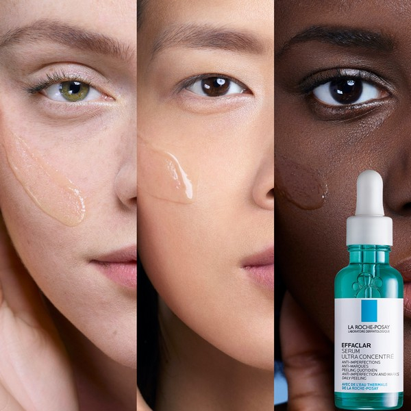 La Roche-Posay Effaclar Siero Peeling Viso Per pelle mista, grassa o a tendenza acneica, in età adulta 30 ml
