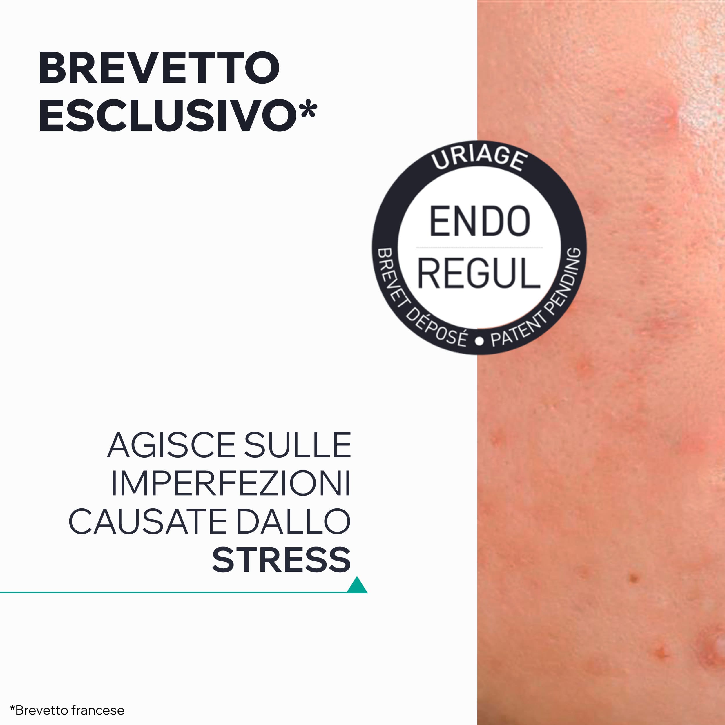 Uriage Hyséac - Siero Anti-Imperfezioni Pelle Nuova Viso 30 ml