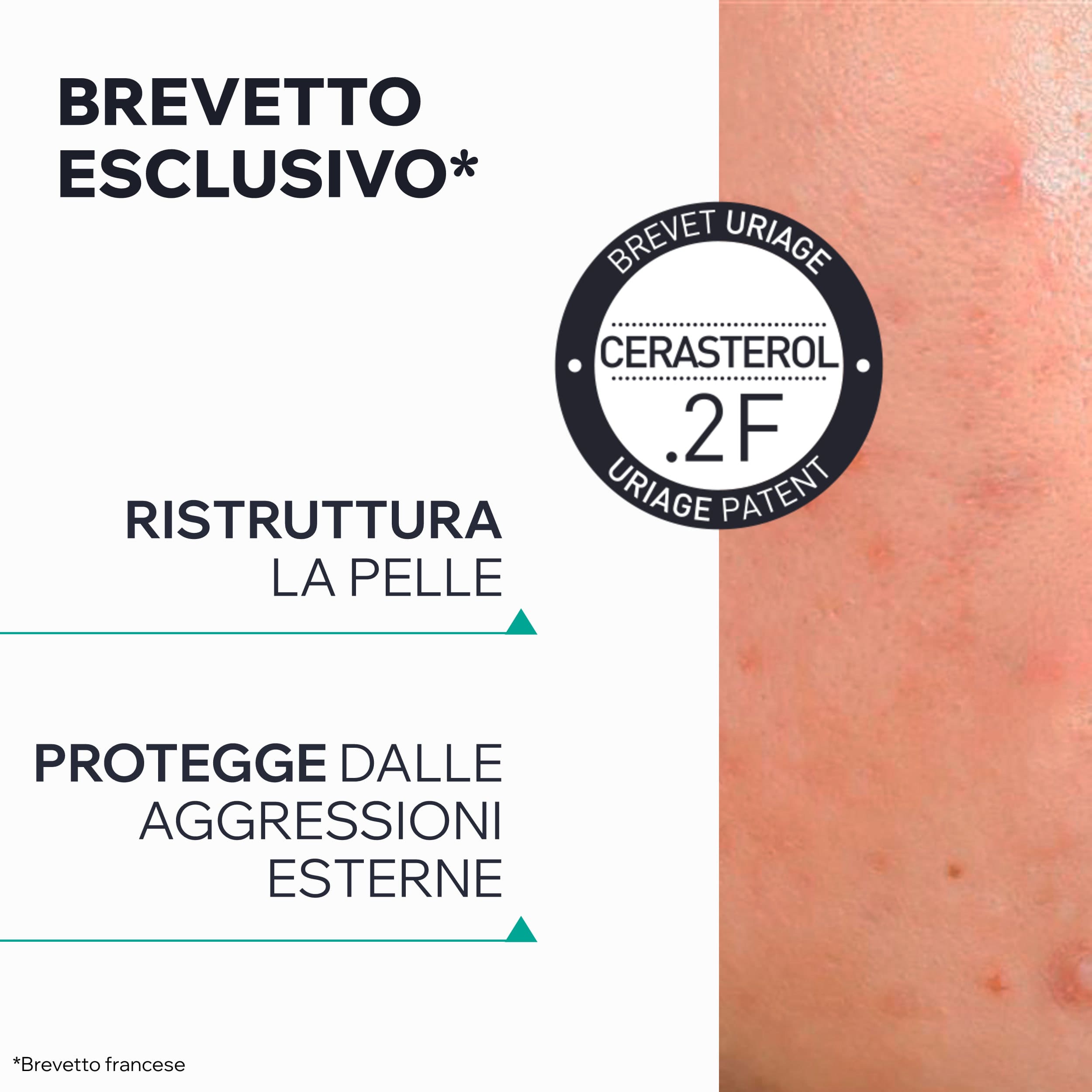 Uriage Hyséac - Hydra Crema Detergente Lenitiva Viso E Corpo Per Pelle Acneica E Irritata 150 ml