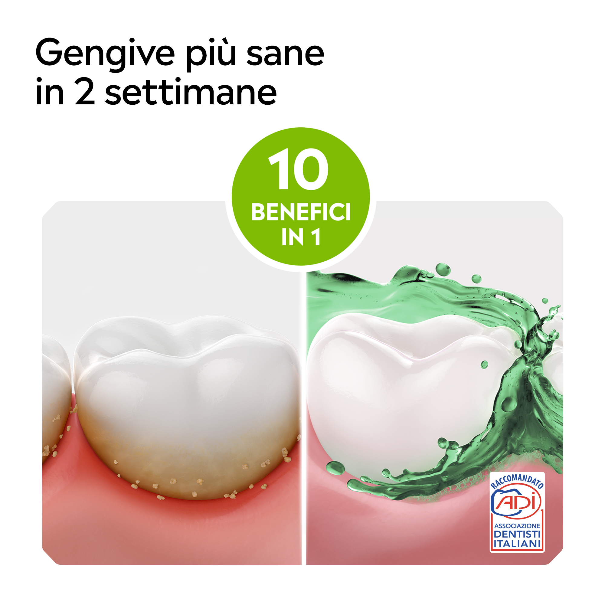 LISTERINE, Collutorio, Difesa Denti e Gengive, Tripla Azione, Denti più Forti, Gengive più Sane, 500ml