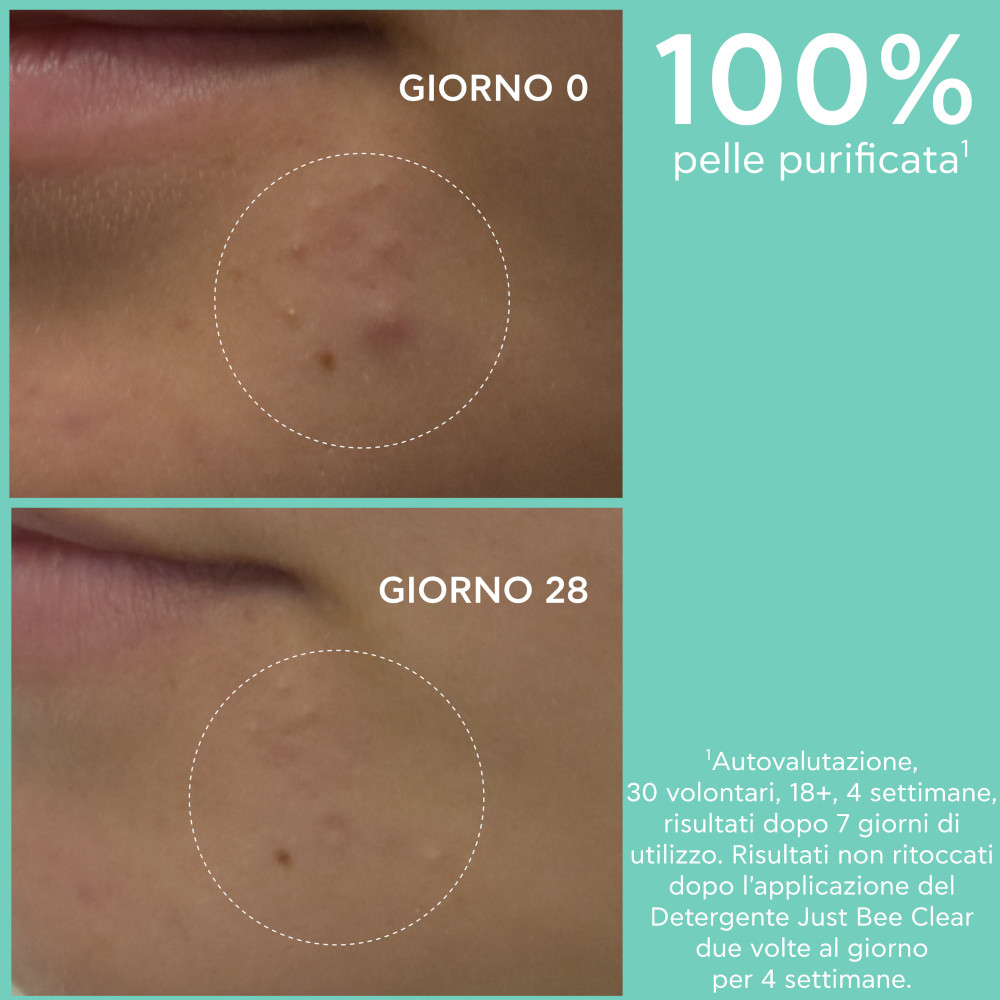 Apivita Just Bee Clear Gel Detergente Purificante