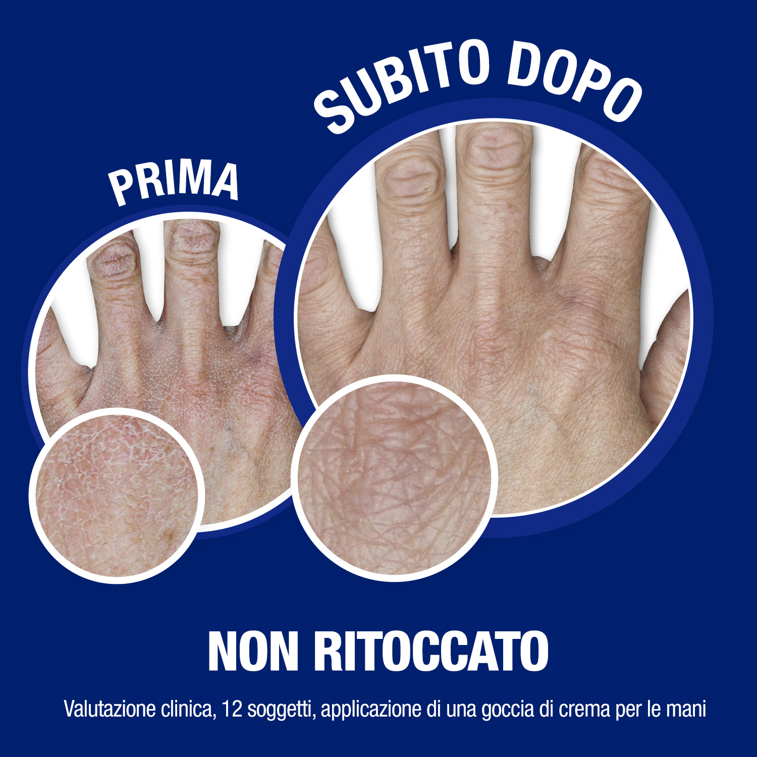 Neutrogena Formula Norvegese Crema Mani e Unghie formula 4 in 1 con Glicerina e Vitamina E 75 ml