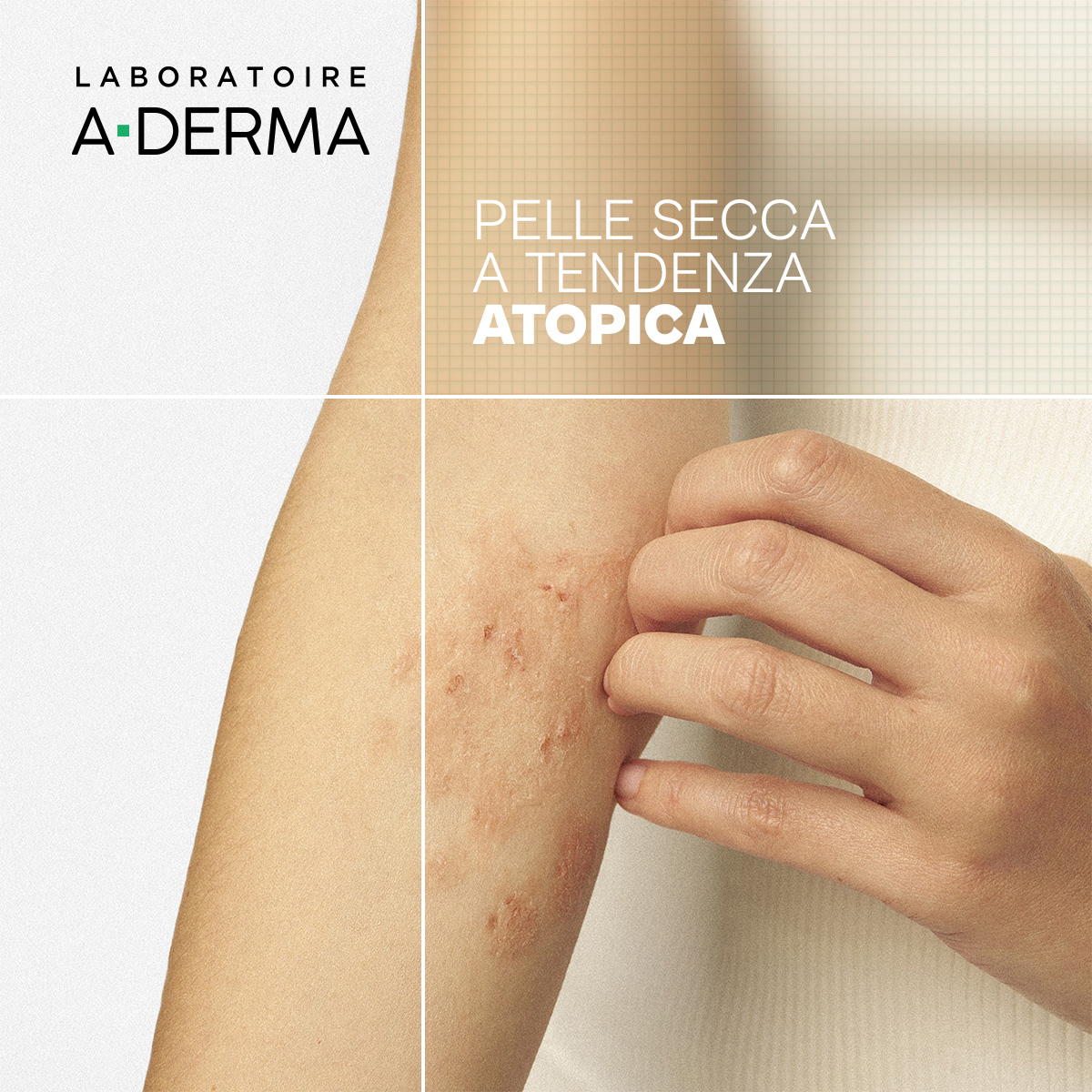 A-Derma Exomega Control Olio lavante emolliente  “anti-grattage”, pelle secca a tendenza atopica, 500ml