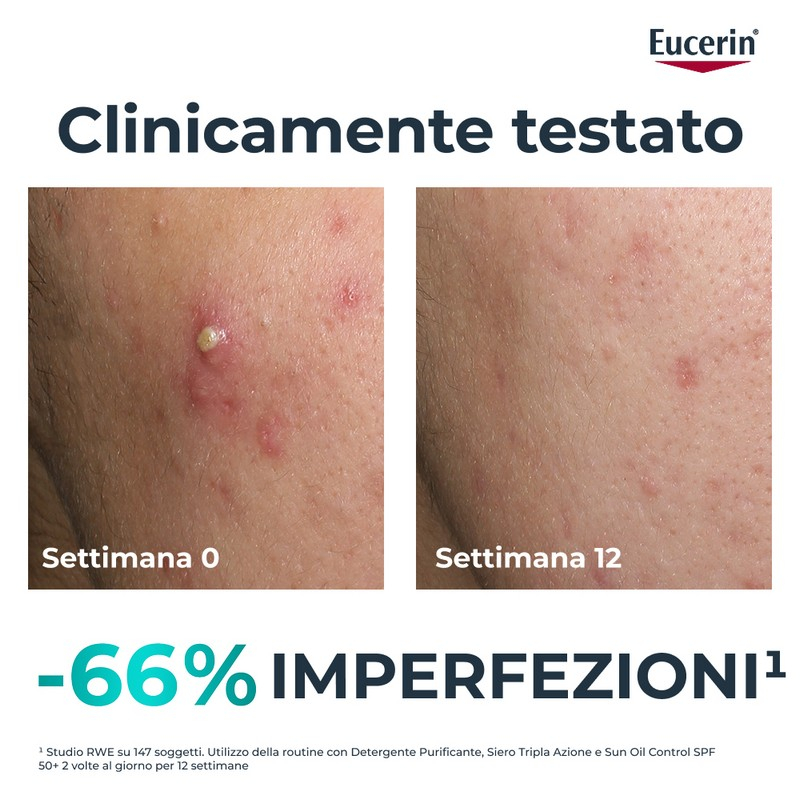 EUCERIN DC SIERO TRIPLA AZ40ML