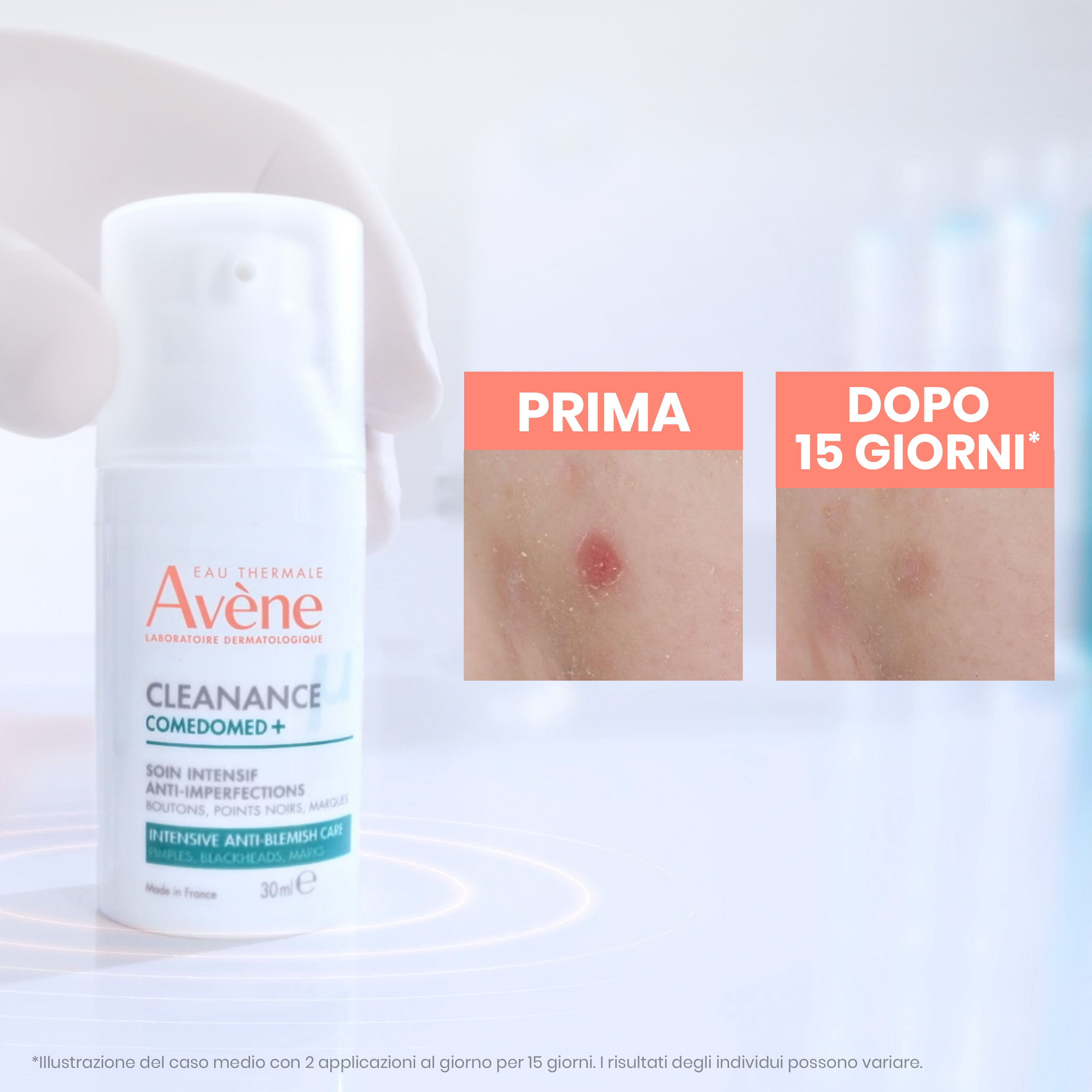 Avène Eau Thermale - Cleanance Comedomed+ Trattamento Intensivo Quotidiano Anti-Imperfezioni 30 ml 
