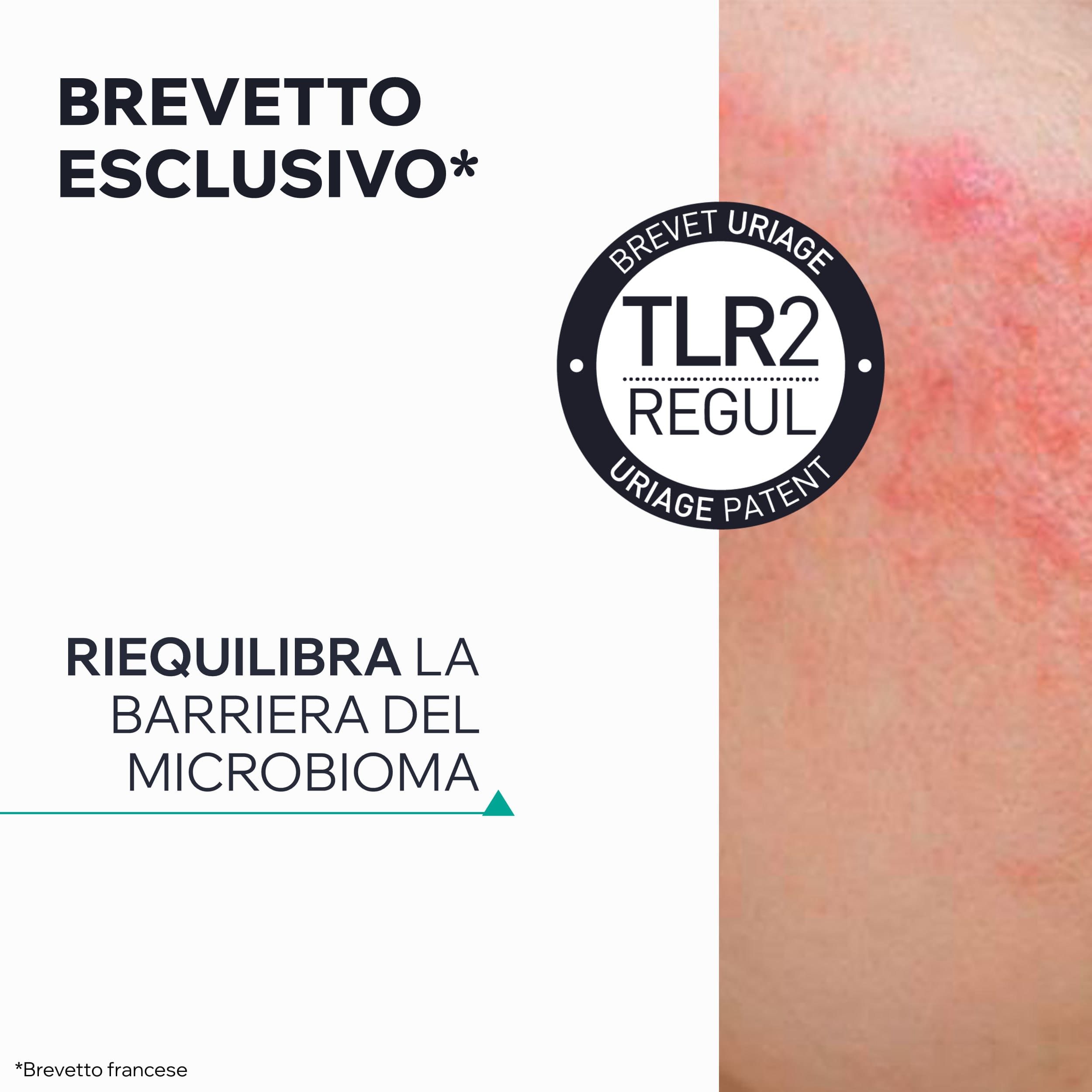 Uriage Hyséac - Hydra Crema Lenitiva Idratante Viso Per Pelle Acneica E Fragilizzata 40 ml