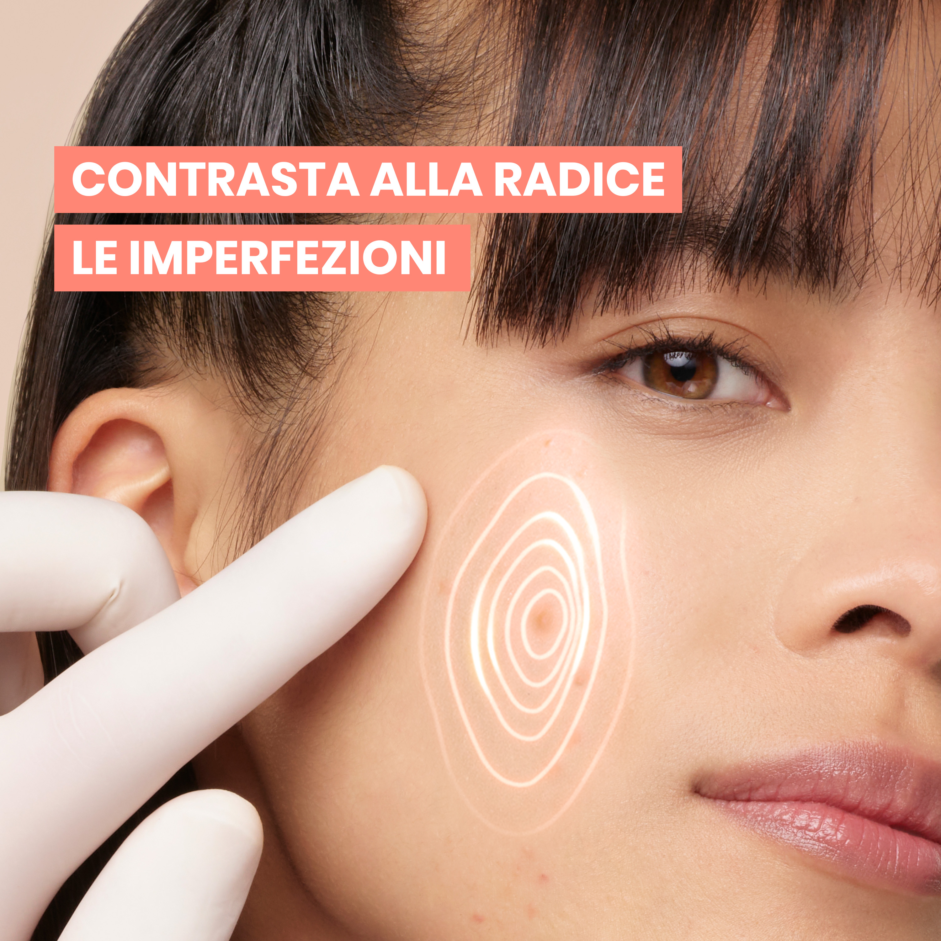 Avène Eau Thermale - Cleanance Comedomed+ Trattamento Intensivo Quotidiano Anti-Imperfezioni 30 ml 
