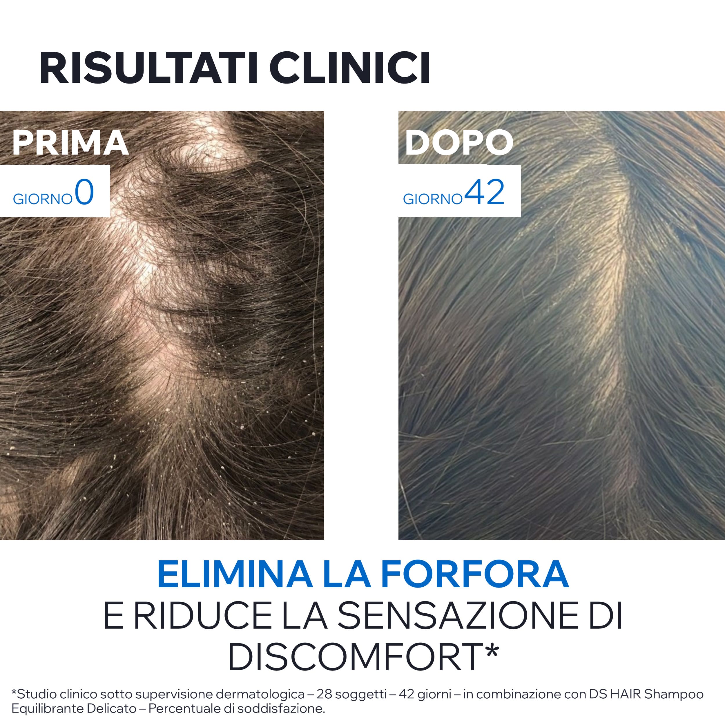 Uriage DS Hair - Shampoo Antiforfora Per Forfora Moderata, Secca O Grassa 500 ml