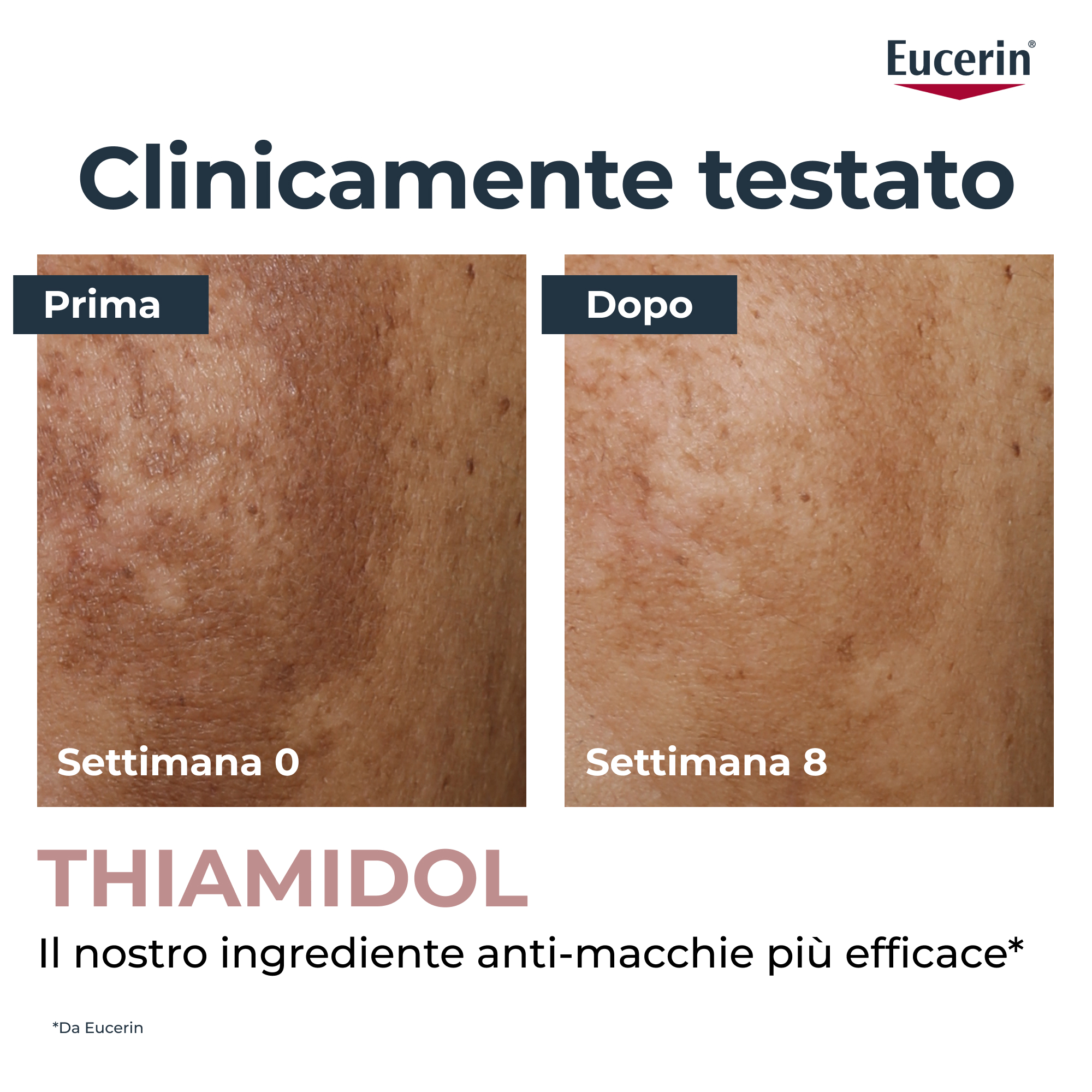 EUCERIN ANTI-PIGMENT Correttore anti-macchie  5ml