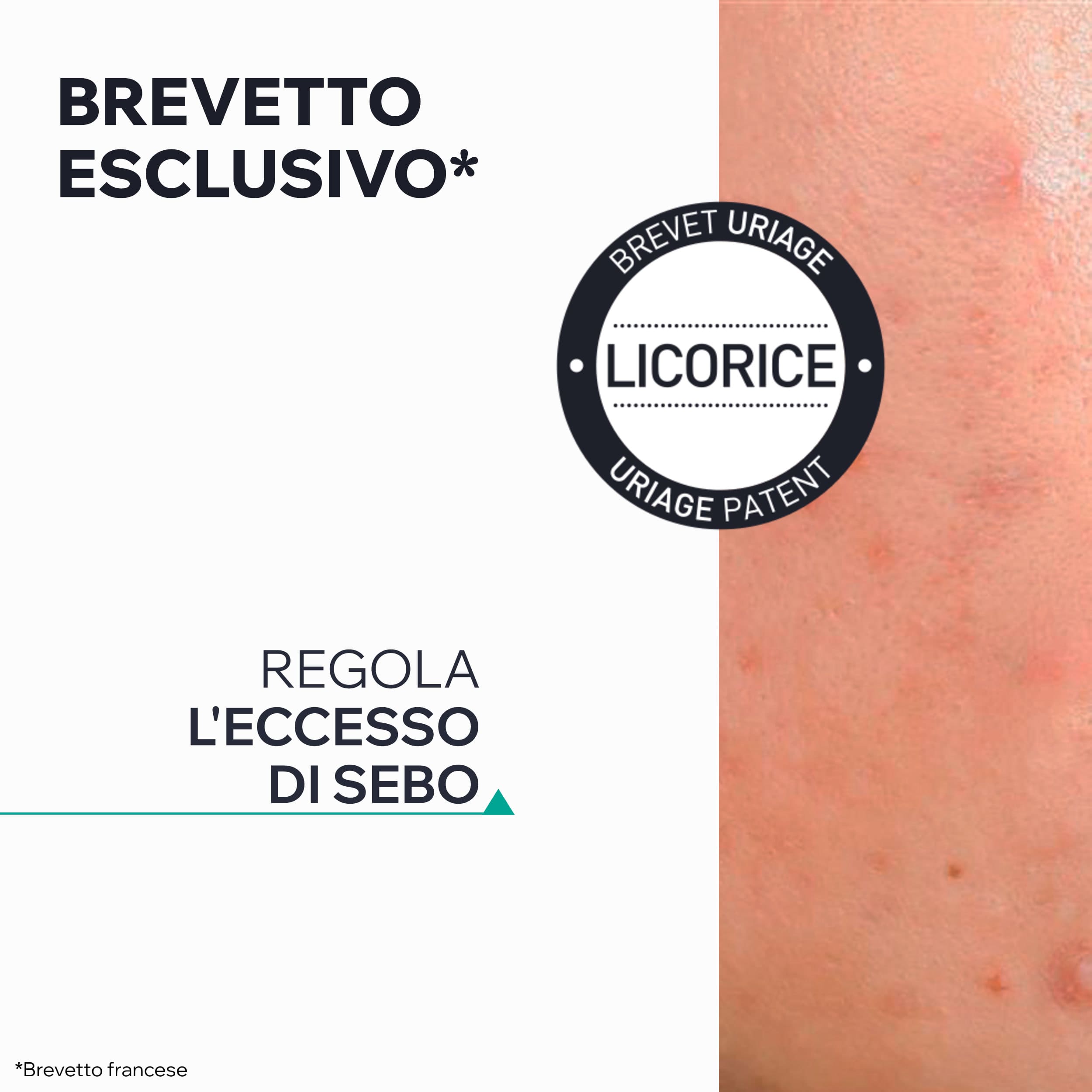 Uriage Hyséac - Gel SOS Purificante Anti-Imperfezioni Viso 15 ml