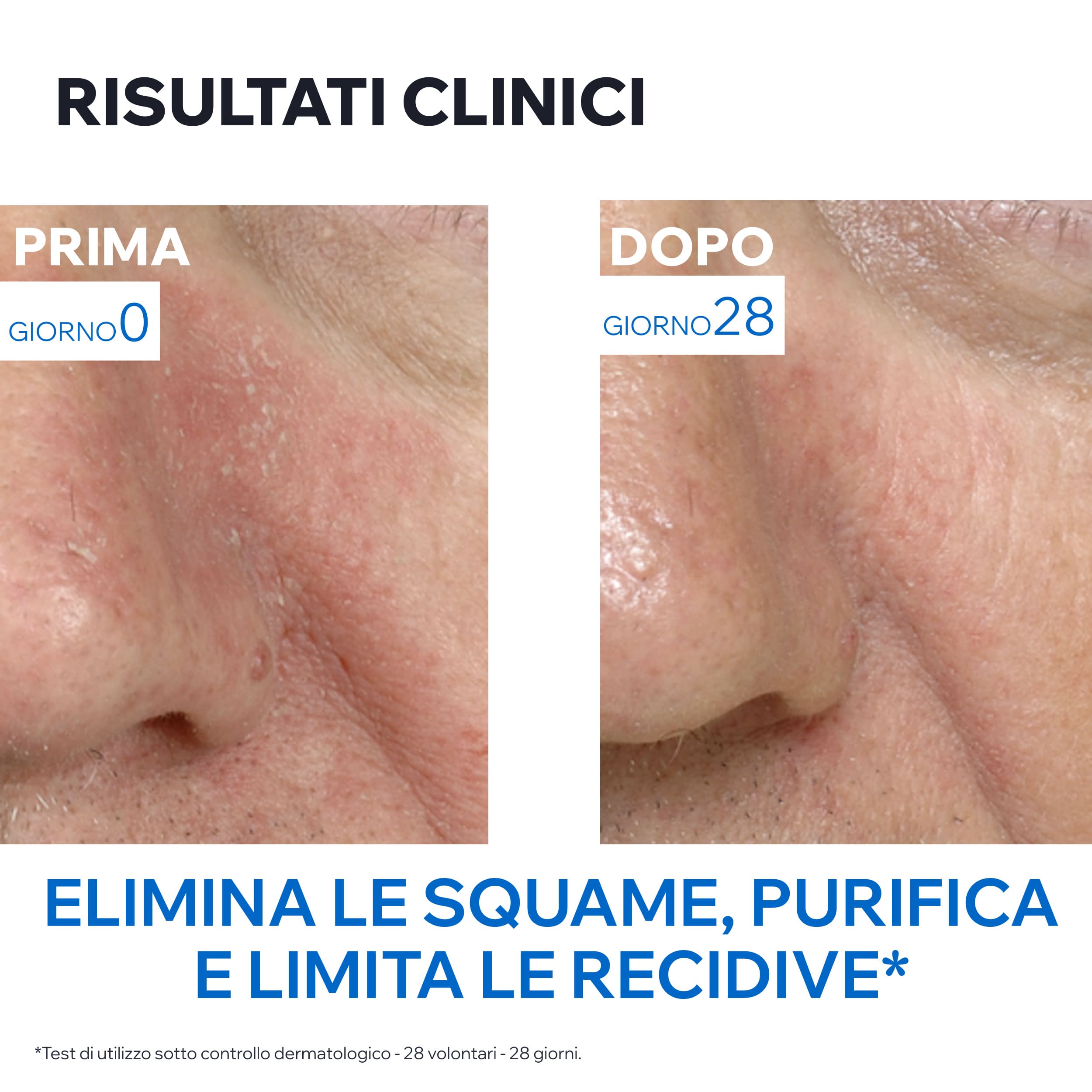 Uriage D.S. - Crema Viso Normalizzante Per Dermatite Seborroica 40 ml