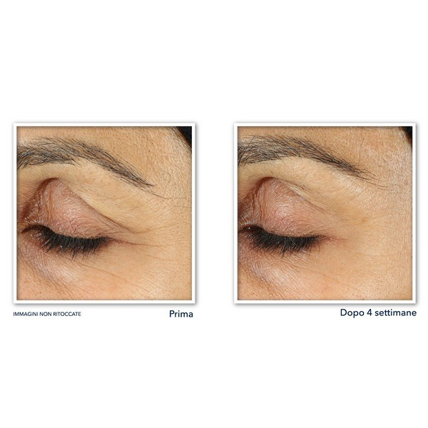 Retinol Correxion® Line Smoothing Crema Occhi - Trattamento occhi 15ml