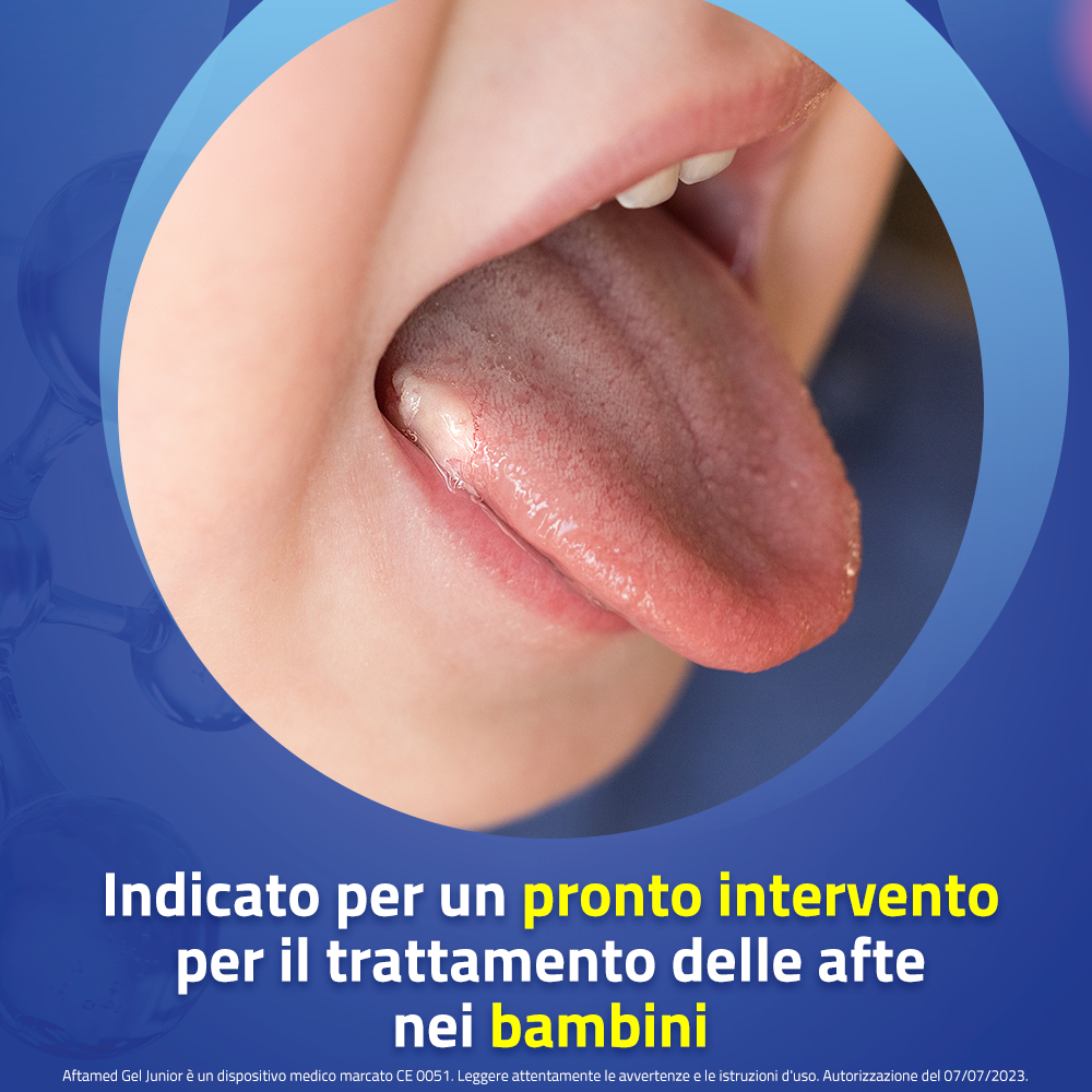 Aftamed Junior Gel Orale Anti Afte Senza Alcool 15 ml