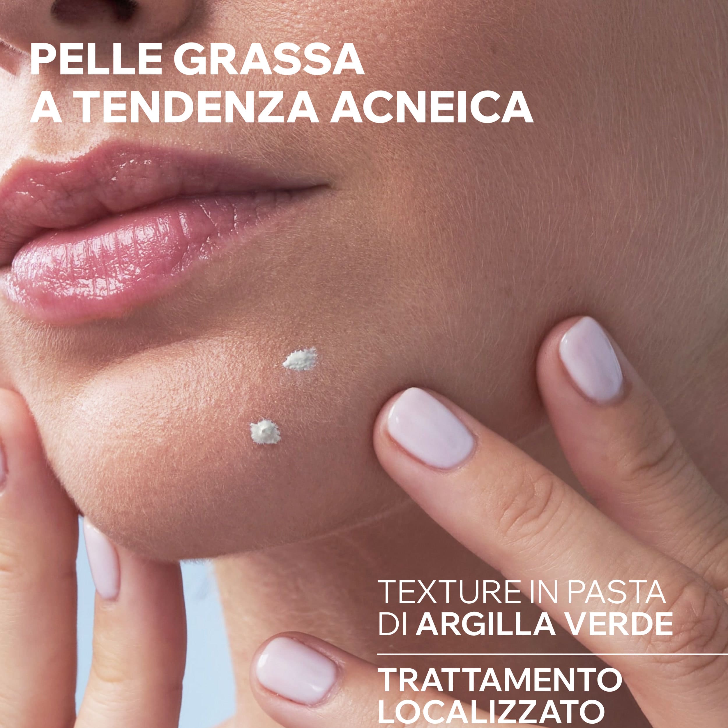 Uriage Hyséac - Pasta SOS Trattamento Notte Anti-Imperfezioni Viso 15 g